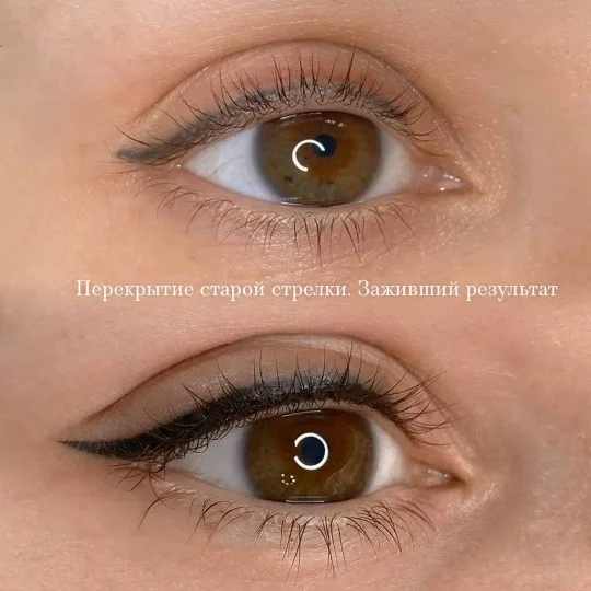 Перекрытие старой стрелки — заживший результат из портфолио Татьяны Бах